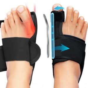 1 Pair Foot Bunion Corrector for Women & Men, 0° & 10° Alignment Bar Support, Night Bunion Splint, Big Toe Straightener, Foot Gear Bunion Brace for Pain Relief